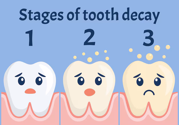 pediatric dentist in Junagadh, children dentist in Junagadh, best pediatric dentist in Junagadh, Parshvi Dental Care, Dr. Bhumika D. Hirpara, tooth decay treatment, kids dental care, pediatric dental clinic, dental check-up for kids, fluoride treatment, dental sealants, baby root canal, tooth-colored fillings, stainless steel crowns, cavity prevention, oral hygiene for children, dental care for kids, space maintainers, kids dental treatment, dental clinic in Junagadh